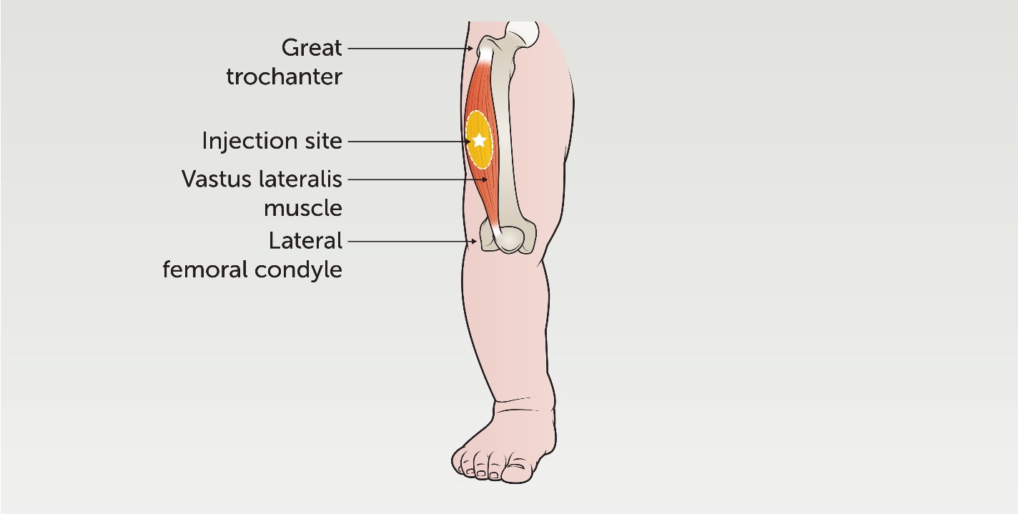 Vastus Lateralis_IM Injection